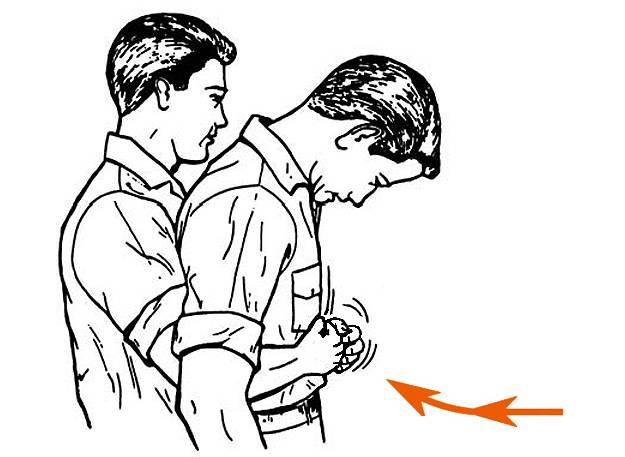 Miért nem alkalmazható mindig a Heimlich-fogás? - Légsegély™