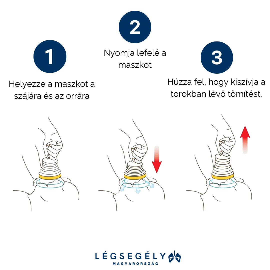 Légsegély™ - Vészhelyzeti szívóeszköz a légutak tisztítására - ErsteLuft™